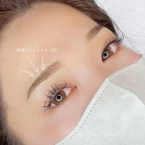 医療アートメイク・眉