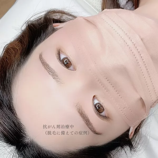 抗がん剤治療中