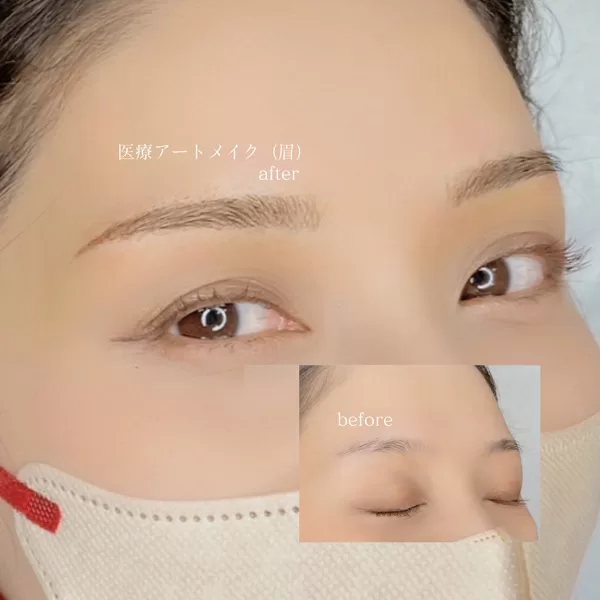 医療アートメイク・眉