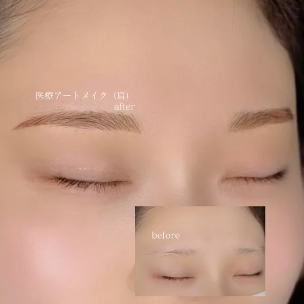 医療アートメイク・眉