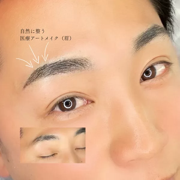 医療アートメイク（眉）・メンズ
